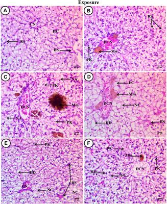 Deleterious effects of polypropylene released from paper cups on blood profile and liver tissue of Clarias gariepinus: bioremediation using Spirulina